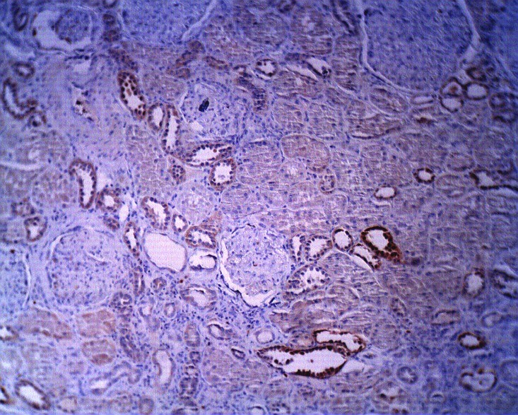  Human kidney section stained with Exalpha’s anti-SMS-1 antibody (Cat X2065P) at 2 ug/ml. Anti-rabbit Ig H+L HRP conjugate (5 ug/ml) without antigen retrieval.